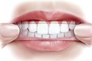 Отбеливающие полоски для зубов: особенности
